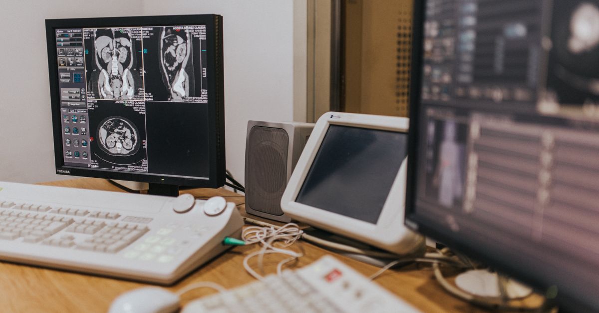 Medical imaging workstation with scans on screen beside a keyboard